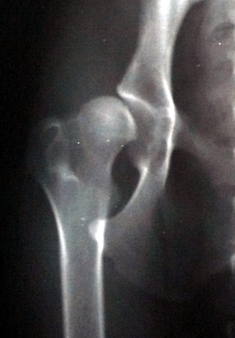 Rotura del ligamento redondo Veterinario Traumatólogo